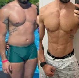 Antes e depois de paciente que emagreceu e ganhou definição muscular com acompanhamento