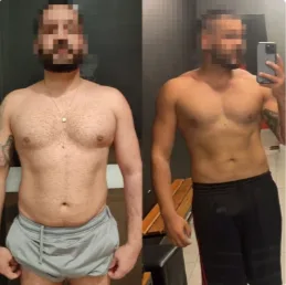 Antes e depois de paciente que emagreceu e ganhou definição muscular com acompanhamento
